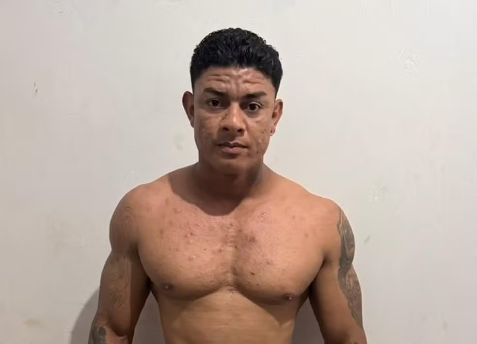 Mulher espancada com dezenas de socos pelo companheiro tem morte cerebral após 10 dias internada no PA