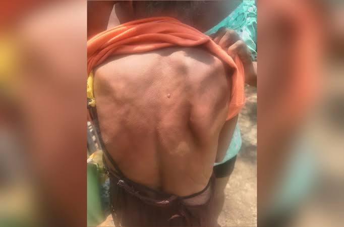 Idosa de 77 anos é agredida pelo próprio filho em Belterra, no Pará